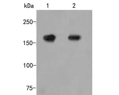 Western Blot: MMR/CD206/Mannose Receptor Antibody (JF0953) [NBP2-66956]