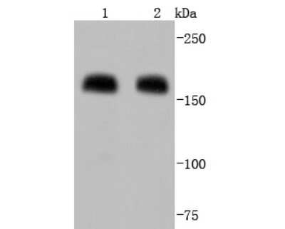 Western Blot: MMR/CD206/Mannose Receptor Antibody (JF0953) [NBP2-66956]