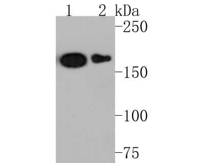 Western Blot: MMR/CD206/Mannose Receptor Antibody (JF0953) [NBP2-66956]