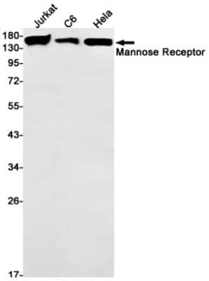 Western Blot: MMR/CD206/Mannose Receptor Antibody (S06-5I1) [NBP3-14900]