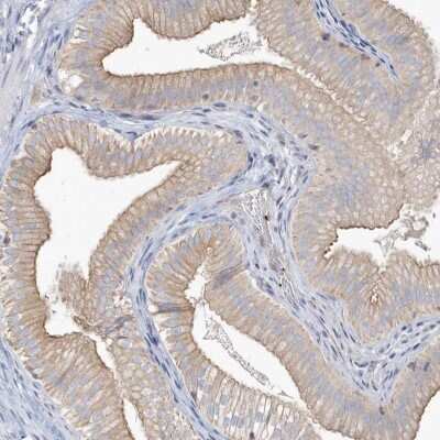 Immunohistochemistry-Paraffin: MMRN1 Antibody [NBP1-84014]