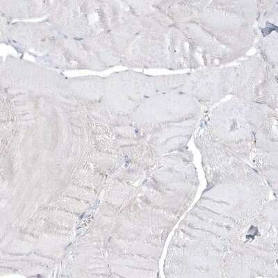 Immunohistochemistry-Paraffin: MMRN1 Antibody [NBP1-84014]