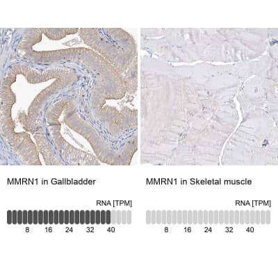 Immunohistochemistry-Paraffin: MMRN1 Antibody [NBP1-84014]