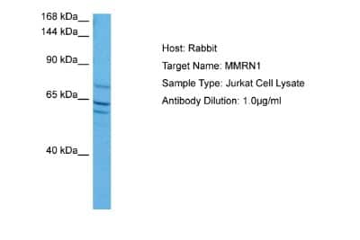 Western Blot: MMRN1 Antibody [NBP2-87810]