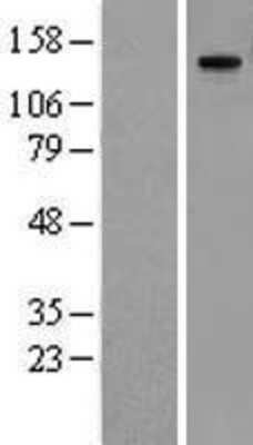 Western Blot: MMRN1 Overexpression Lysate [NBL1-13163]