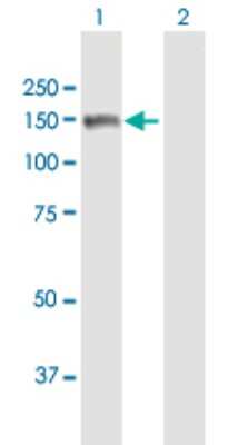 Western Blot: MMRN2 Antibody [H00079812-B01P]