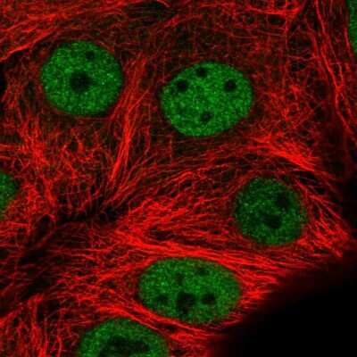 Immunocytochemistry/ Immunofluorescence: MMS19 like protein Antibody [NBP2-55388]