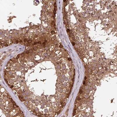 Immunohistochemistry: MMS19 like protein Antibody [NBP2-47371]