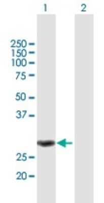 Western Blot: MMS19 like protein Antibody [H00064210-B01P]