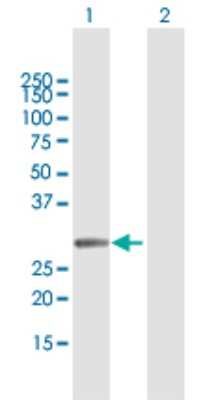 Western Blot: MMS19 like protein Antibody [H00064210-B02P]