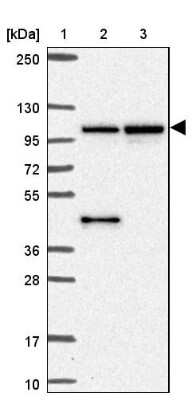 Western Blot: MMS19 like protein Antibody [NBP2-47371]