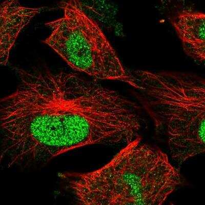 Immunocytochemistry/ Immunofluorescence: MMS22L Antibody [NBP2-57743]