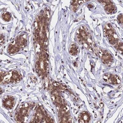Immunohistochemistry-Paraffin: MMTAG2 Antibody [NBP1-92128]