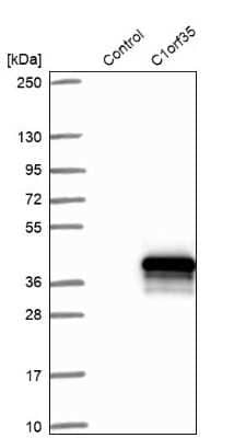 Western Blot: MMTAG2 Antibody [NBP1-92128]