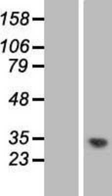 Western Blot: MMTAG2 Overexpression Lysate [NBL1-08319]