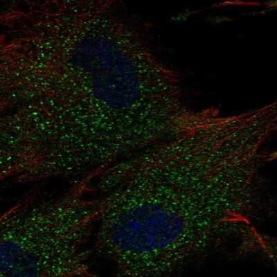 Immunocytochemistry/ Immunofluorescence: MNAB Antibody [NBP2-68785]