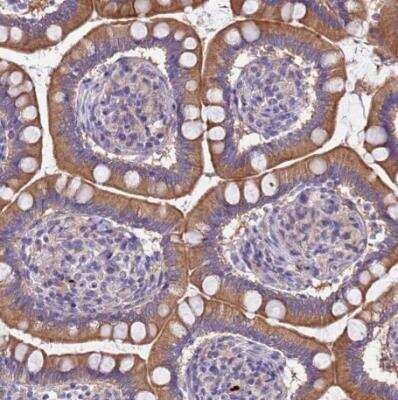 Immunohistochemistry-Paraffin: MNAB Antibody [NBP2-13212]