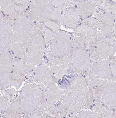 Immunohistochemistry-Paraffin: MNAB Antibody [NBP2-13212]