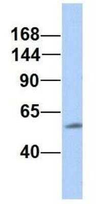 Western Blot: MNAB Antibody [NBP1-55060]