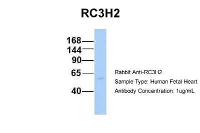 Western Blot: MNAB Antibody [NBP1-55060]