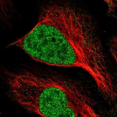 Immunocytochemistry/ Immunofluorescence: MNAT1 Antibody [NBP2-55265]