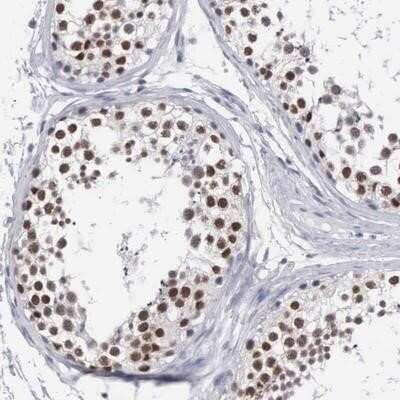 Immunohistochemistry-Paraffin: MNAT1 Antibody [NBP1-81257]