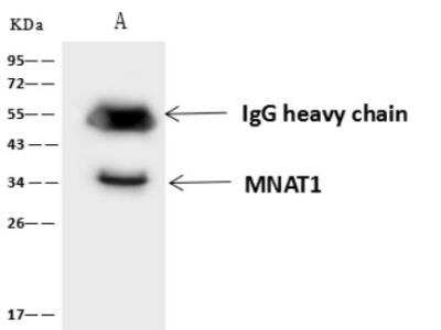 Immunoprecipitation: MNAT1 Antibody [NBP3-06477]