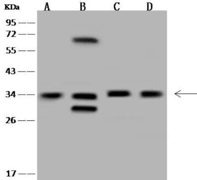 Western Blot: MNAT1 Antibody [NBP3-06477]