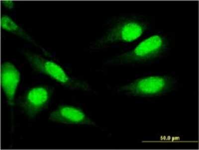 Immunocytochemistry/ Immunofluorescence: MNDA Antibody (1H2) [H00004332-M01]