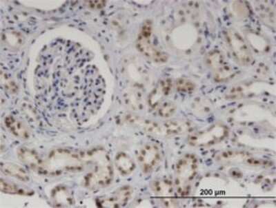 Immunohistochemistry-Paraffin: MNDA Antibody (1H2) [H00004332-M01]