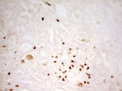 Immunohistochemistry: MNDA Antibody (OTI4H6) [NBP2-45907]