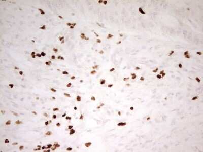 Immunohistochemistry: MNDA Antibody (OTI4H6) [NBP2-45907]