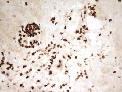Immunohistochemistry: MNDA Antibody (OTI4H6) [NBP2-45907]