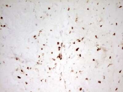 Immunohistochemistry: MNDA Antibody (OTI4H6) [NBP2-45907]