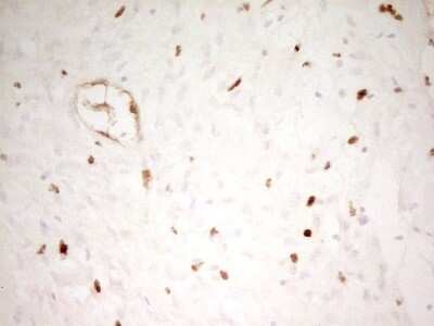 Immunohistochemistry: MNDA Antibody (OTI4H6) [NBP2-45907]