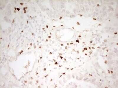 Immunohistochemistry: MNDA Antibody (OTI4H6) [NBP2-45907]