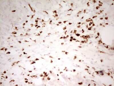 Immunohistochemistry: MNDA Antibody (OTI4H6) [NBP2-45907]