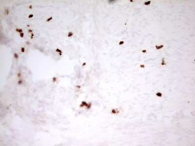 Immunohistochemistry: MNDA Antibody (OTI4H6) [NBP2-45907]