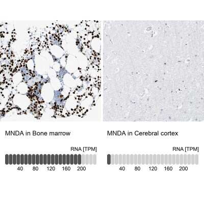 Immunohistochemistry-Paraffin: MNDA Antibody [NBP1-87180]