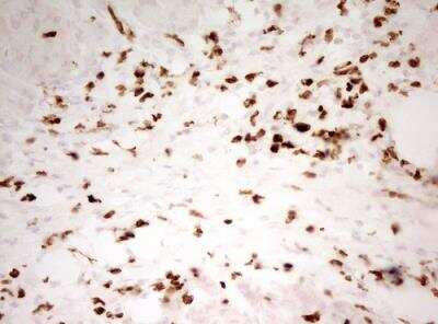 Immunohistochemistry-Paraffin: MNDA Antibody (OTI4H6) - Azide and BSA Free [NBP2-72741]