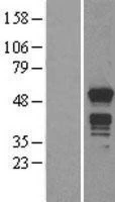 Western Blot: MNDA Overexpression Lysate [NBL1-13165]