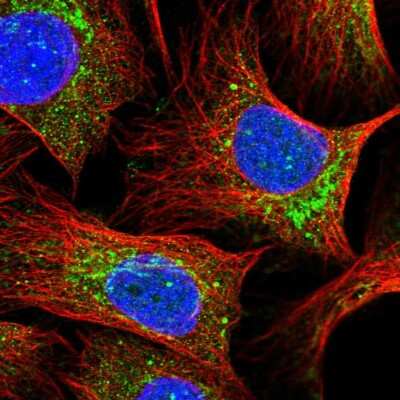Immunocytochemistry/ Immunofluorescence: MNF1 Antibody [NBP2-14240]