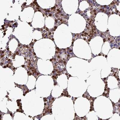 Immunohistochemistry-Paraffin: MNF1 Antibody [NBP2-14240]