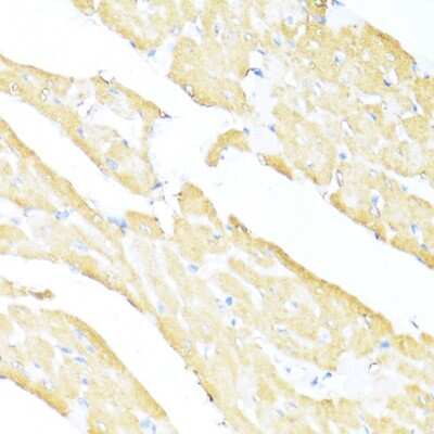 Immunohistochemistry-Paraffin: MNF1 Antibody - BSA Free [NBP3-03480]