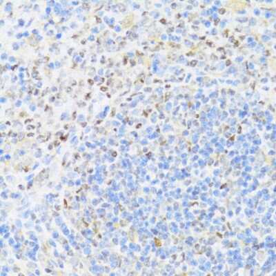 Immunohistochemistry-Paraffin: MNF1 Antibody - BSA Free [NBP3-03480]