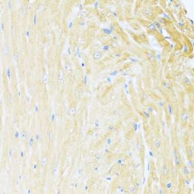 Immunohistochemistry-Paraffin: MNF1 Antibody - BSA Free [NBP3-03480]