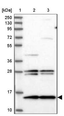 Western Blot: MNF1 Antibody [NBP2-14240]