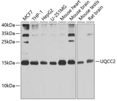 Western Blot: MNF1 AntibodyBSA Free [NBP3-03480]