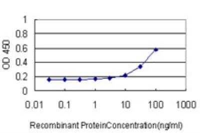 ELISA: MNK1 Antibody (2C5) [H00008569-M07]