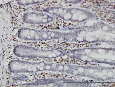 Immunohistochemistry-Paraffin: MNK1 Antibody (2F12) [H00008569-M14]